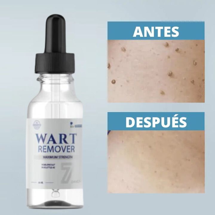 WART REMOVER | REMOVEDOR DE VERRUGAS Y LUNARES
