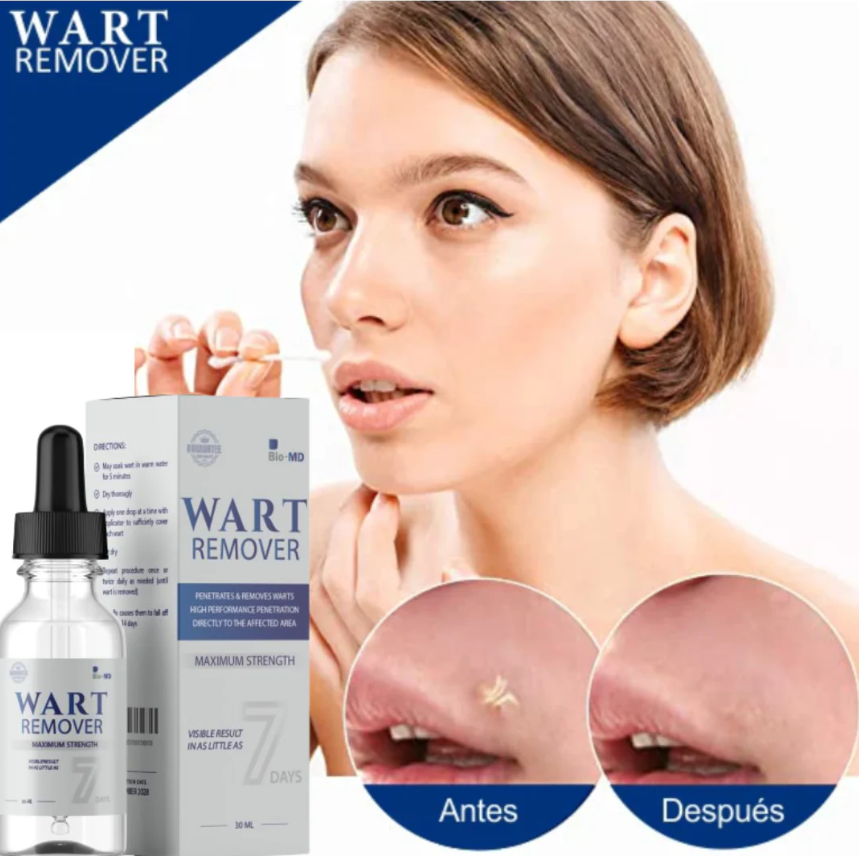 WART REMOVER | REMOVEDOR DE VERRUGAS Y LUNARES