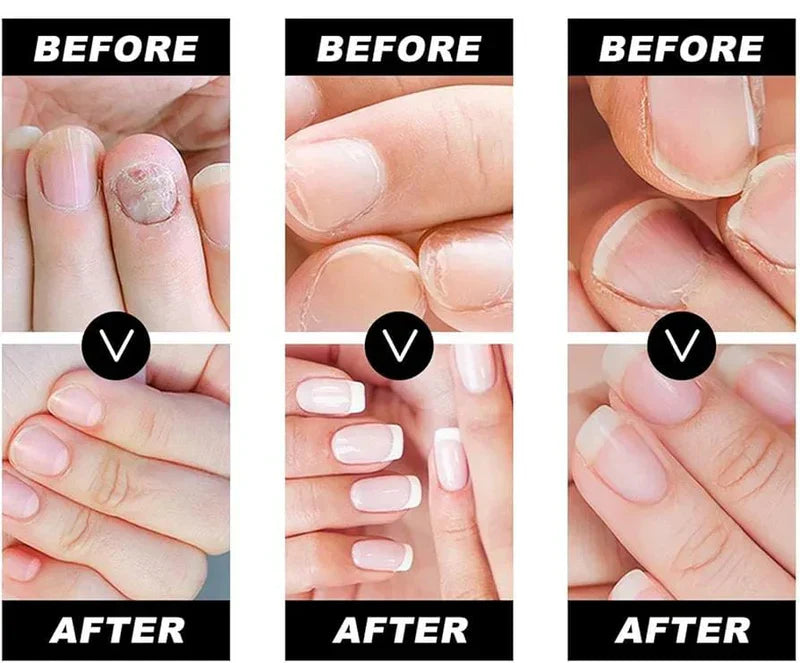 NAILS REPAIRER® | SUERO REPARADOR DE UÑAS