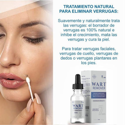 WART REMOVER | REMOVEDOR DE VERRUGAS Y LUNARES